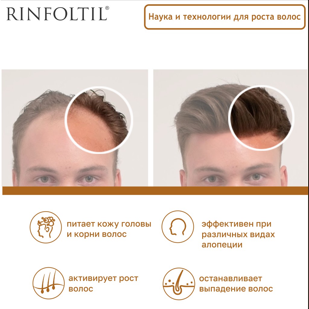 Ринфолтил сыворотка липосомальная против выпадения волос для мужчин флакон 160мг N 30