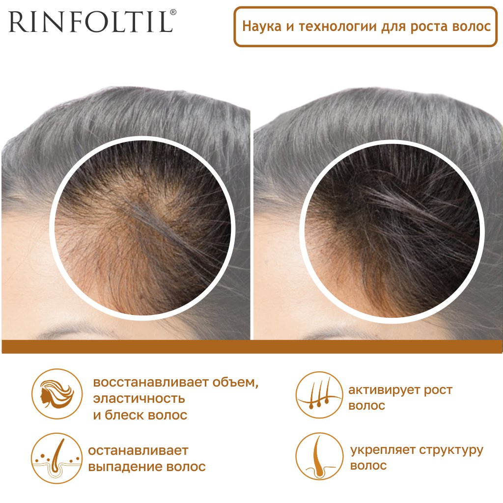 Ринфолтил сыворотка липосомальная против выпадения волос при любом типе для женщин и мужчин флакон 160мг N 30