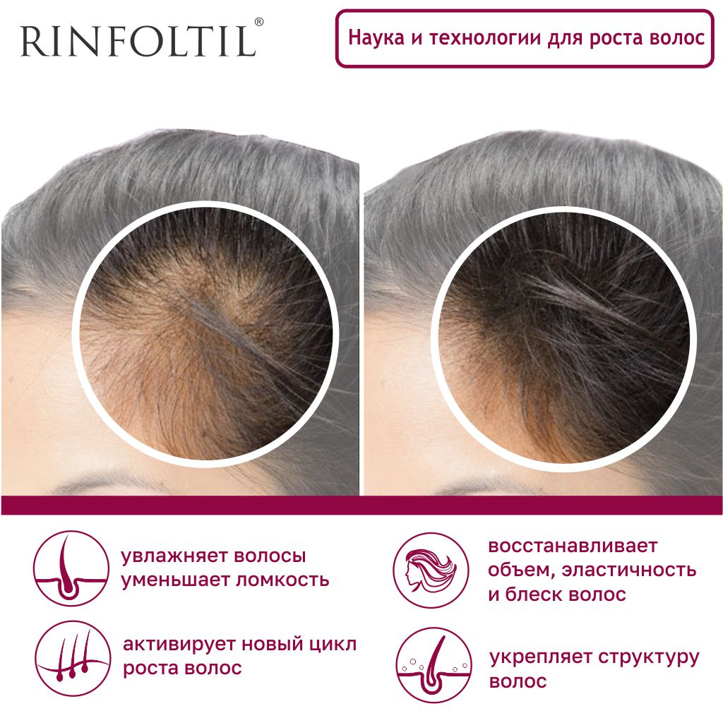 Ринфолтил сыворотка липосомальная против выпадения волос для ослабленных и истонченных волос флакон 160мг N 30